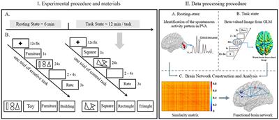 Spontaneous Activity in Primary Visual Cortex Relates to Visual Creativity